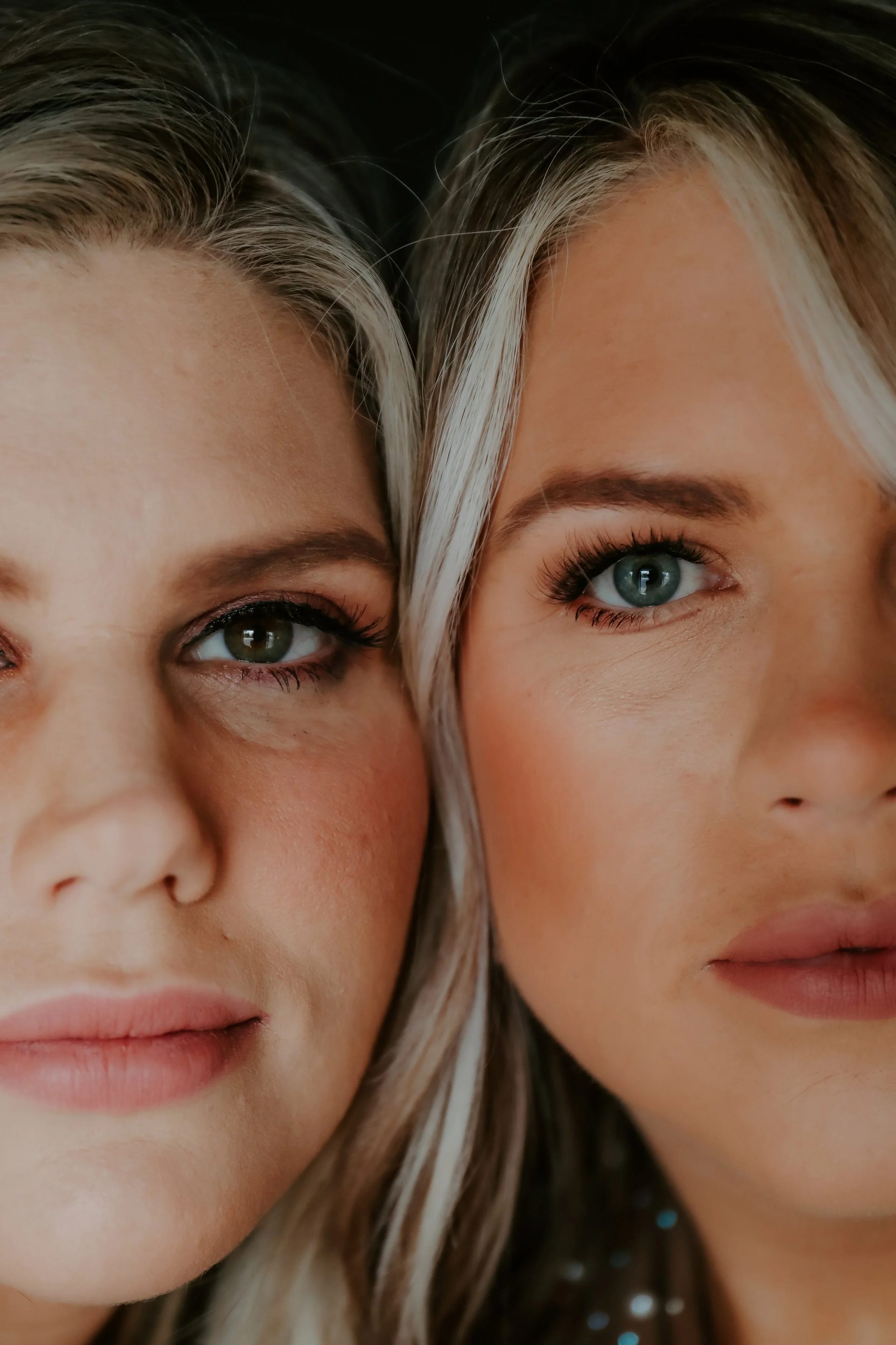 Close-up of two clients' eyes and skin after injectable treatment at All About Monroe