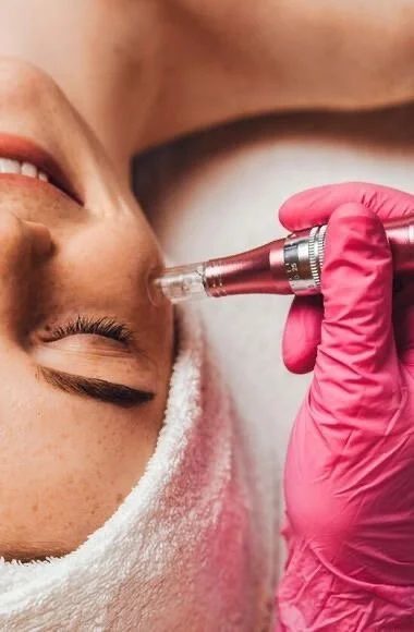 Skin treatment pen applied to a client's face at All About Monroe in Demorest, Georgia